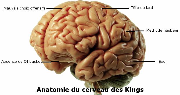 cerveau des sacramento kings
